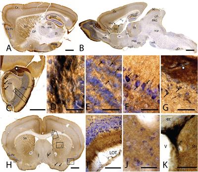 Location of the Cell Adhesion Molecule “Coxsackievirus and Adenovirus Receptor” in the Adult Mouse Brain